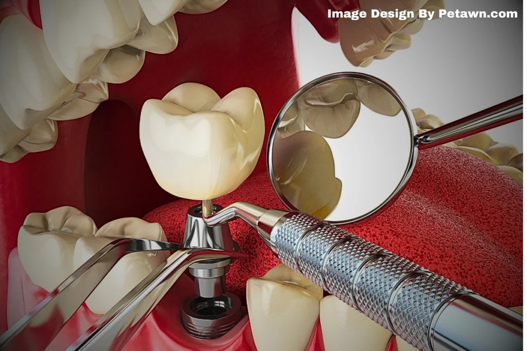 Understanding Tooth Extraction Recovery